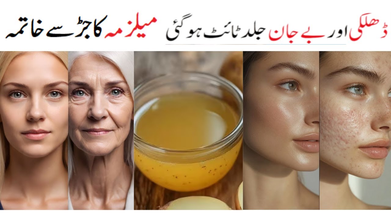 I Erased My Wrinkles & Melasma NATURALLY Discover My Secret YouTube