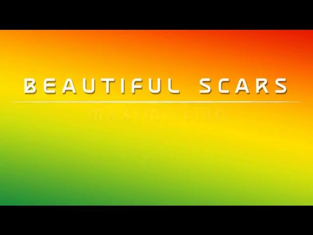 BEAUTIFUL SCARS _ MAXIMILLIAN REGGAE VERSION