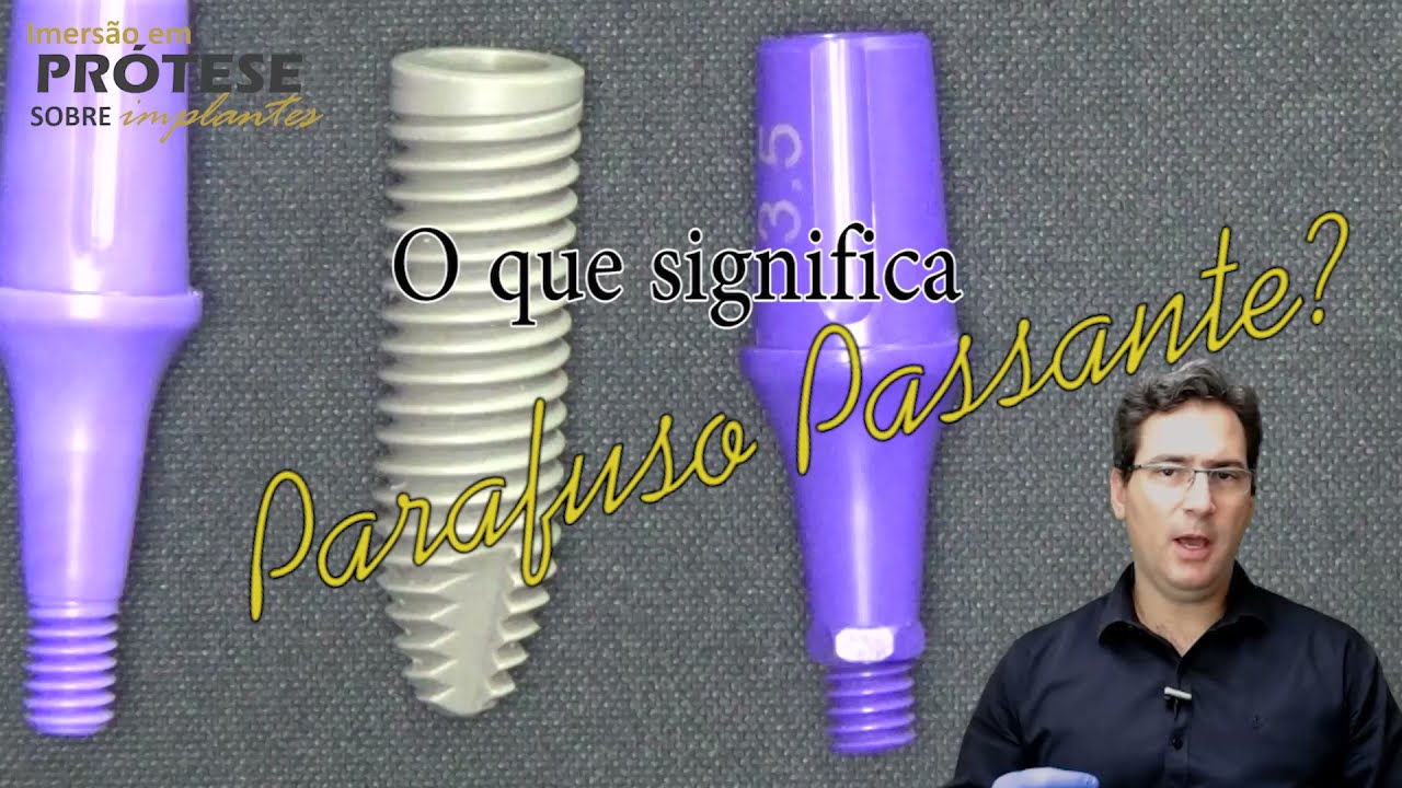 Parafuso Passante: Curso Imersão em Prótese Sobre Implante. - YouTube