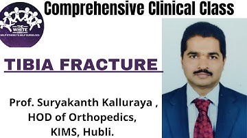 TIBIA FRACTURE - Clinical case presentation