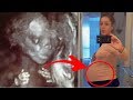 This Woman’s Baby Bump Keeps Growing, Then Doctor Spots Something Unusual In Ultrasound