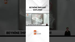 Yanlış Tedavi Öldürüyordu