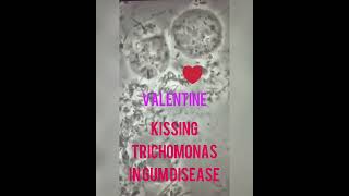 Valentine Trichos kissing in Gum Disease !