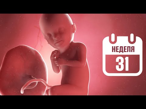 Видео: 31 неделя беременности - Что ожидать