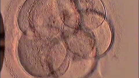 Day 3 Embryo Blastomere Biopsy for PGD