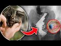 Crazy Things Found Inside Human Body | Human Body | Crazy FACTS