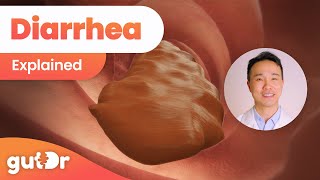 Diarrhea | Explained by Dr. Vincent Ho (3D Gut Animation) screenshot 5