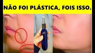 Não foi Plástica Foi Isso – para Manchas e Rugas