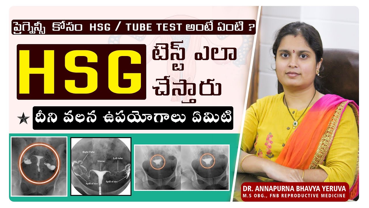 HSG in Telugu / ప్రెగ్నన్సీ కోసం ట్యూబ్ టెస్ట్ .. HSG గురించి తెలుసుకోండి