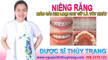 Niềng răng mắc cài sứ hay kim loại loại nào tốt hơn