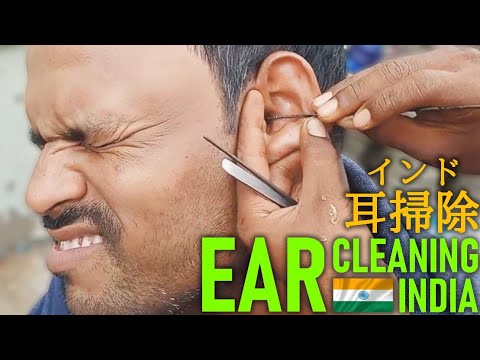 路上耳かき/耳掃除 インド Ear Cleaning India ASMR