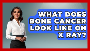 What Does Bone Cancer Look Like on X Ray? - Oncology Support Network