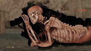 #208 Multiplayer "CRAZY Compilation" | Sniper Elite 4 THANKSGIVING