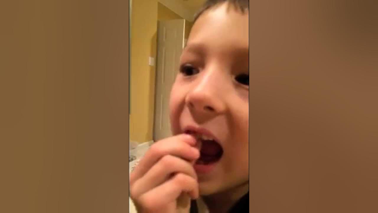 Best way to pull loose tooth String Method YouTube