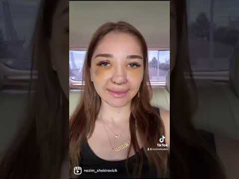 #rinoplastiachec#rinoplastiadushanbe. Нозим Шокирович ринопластика. г. Душанбе . клиника Ибни Сино