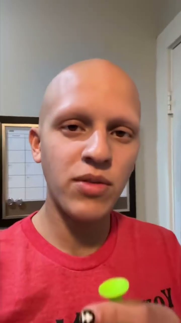 Why doesn’t this video blow up on YouTube ? #comedy #funny #alopecia