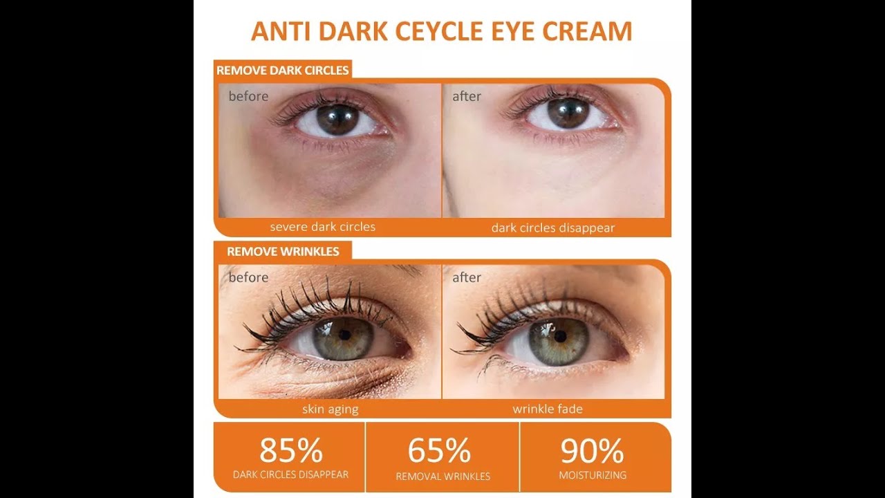 Anti Dark Circle Eyes Care Cream Eye Bags Removal Wrinkle Contour