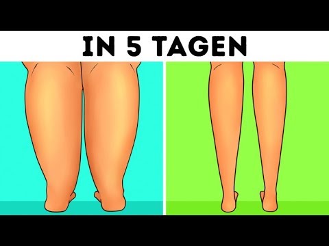 Video: 3 Wege, dich zu befreien, wenn du gefesselt bist