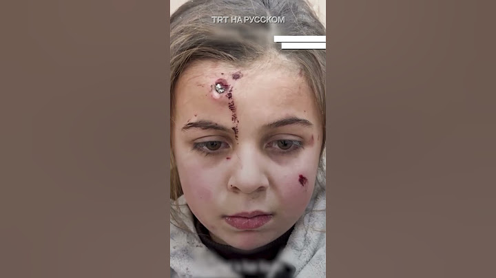Осколок израильского снаряда застрял в голове палестинской девочки