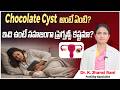 What is Chocolate Cyst? | How Does Chocolate Cyst Effects in Fertility | Endometriosis | Origins IVF