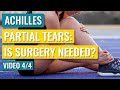 Does a Partially Torn Achilles Require Surgery?