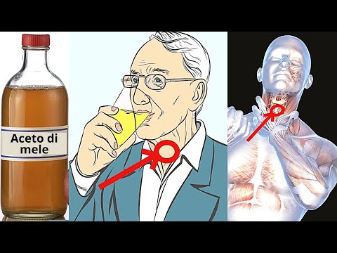 Video: Perché l'aceto aiuta a scottarsi?