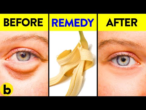 Video: 23 Banana Peel Gebruikt: Voor Huidverzorging, Haargezondheid, Eerste Hulp En Meer