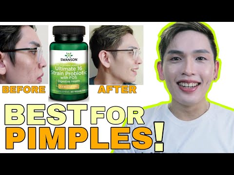 BEST FOR PIMPLES NA SUPPLEMENT? SWANSON ULTIMATE 16 STRAIN PROBIOTICS | NEED MO 'TO! SIR LAWRENCE