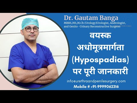 वयस्क अधोमूत्रमार्गता (Hypospadias) पर पूरी जानकारी - glanular hypospadias | Dr. Gautam Banga