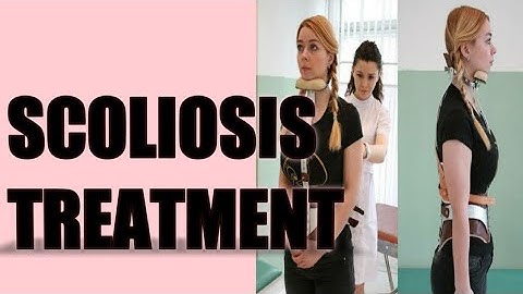 SCOLIOSIS (PART-2)| Treatment of scoliosis