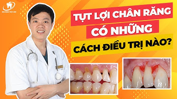 Tụt lợi chân răng, có những cách điều trị nào?