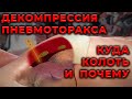 Пневмоторакс. Куда, как и почему вводить декомпрессионную иглу. #ПроСМП