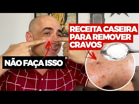 4 RECEITAS CASEIRAS PARA PELE: Contra Cravos, Espinhas, Oleosidade e Manchas | Camilla Amaral. 