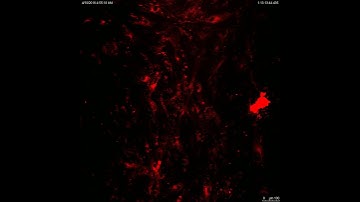 MSC phagocyte mitochondria