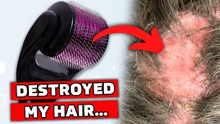 6 personnes qui ne devraient PAS se faire micro-aiguilleter le cuir chevelu