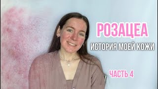 видео: РОЗАЦЕА. ИСТОРИЯ МОЕЙ КОЖИ. ЧАСТЬ 4: НОВЫЙ ПОДХОД К ЛЕЧЕНИЮ картинка: РОЗАЦЕА. ИСТОРИЯ МОЕЙ КОЖИ. ЧАСТЬ 4: НОВЫЙ ПОДХОД К ЛЕЧЕНИЮ