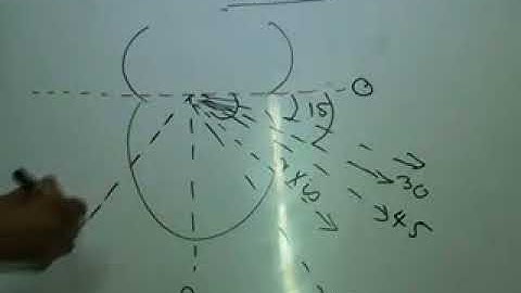 CVS ECG Part 5 Dr Mohamed Fayez