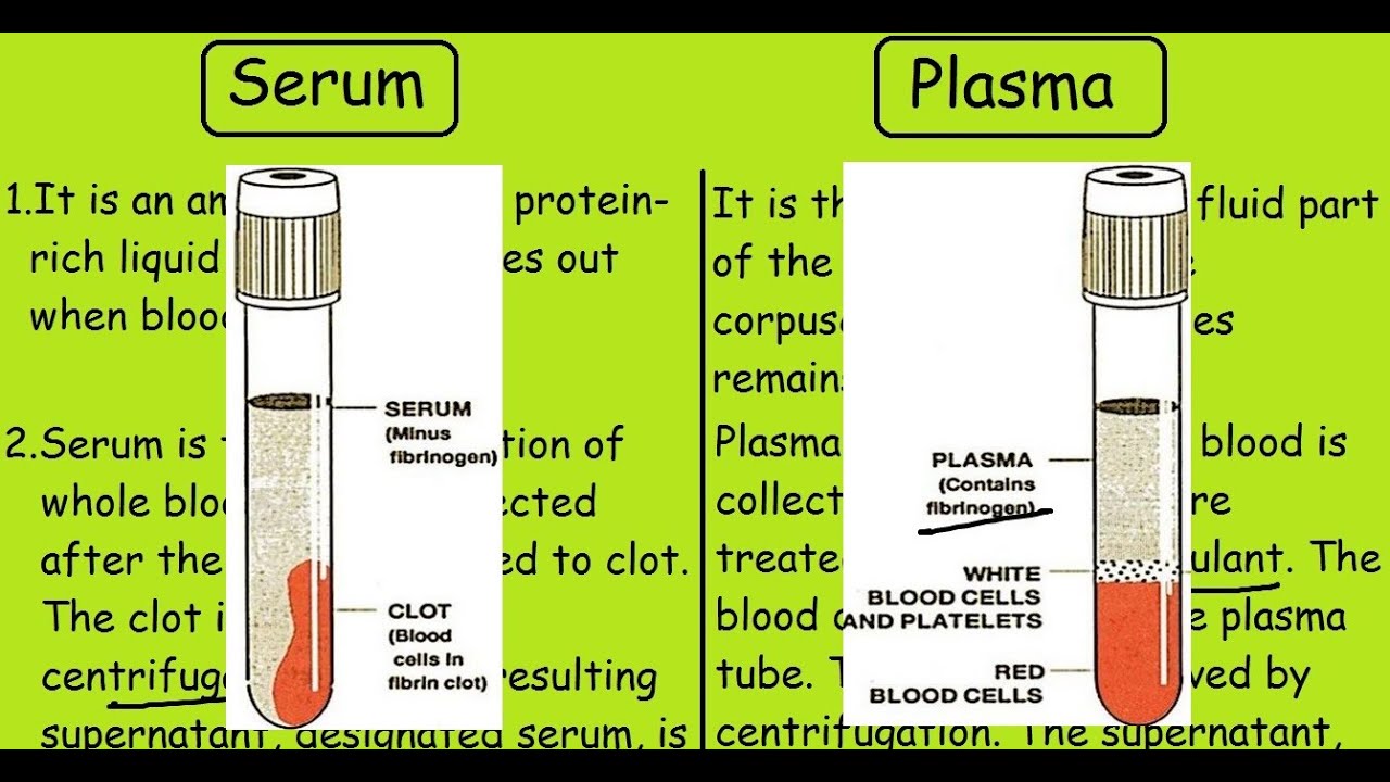 how can you visually tell serum from plasma?