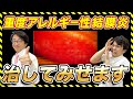 眼科医解説 どこの眼科でも治らなかった 治療法と日常でしてはいけないこと 眼科医解説 どこの眼科でも治らなかった 治療法と日常でしてはいけないこと