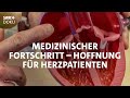 Rettung fürs Herz - Stent, Bypass, Klappenersatz | SWR Doku