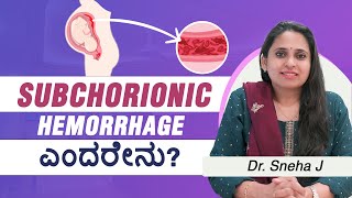 Bleeding in early pregnancy Know about Subchorionic Hemorrhage - one of the causes