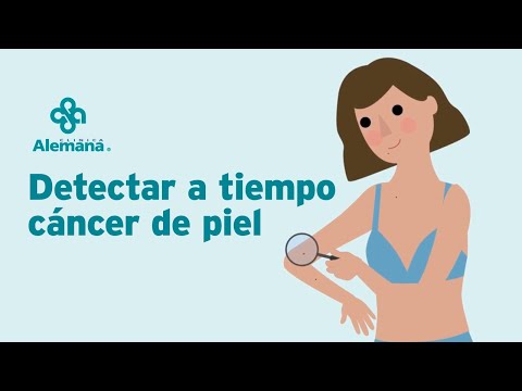 Video: Cómo prevenir el cáncer de piel de células escamosas: 14 pasos (con imágenes)