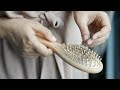 تساقط الشعر... أسبابه وحلوله | Hair Loss: Causes & Simple Tips الشعر # hair #نصائح_دوائية