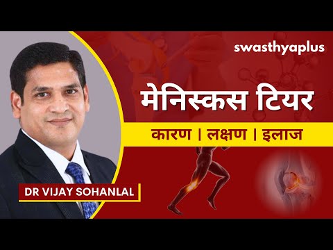 मेनिस्कस का फटना क्या है? | What is Meniscus Tear? in Hindi | Knee Pain | Dr Vijay Sohanlal