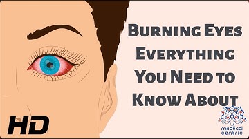 Burning Eyes: Everything You Need to Know