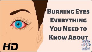 Burning Eyes: Everything You Need to Know