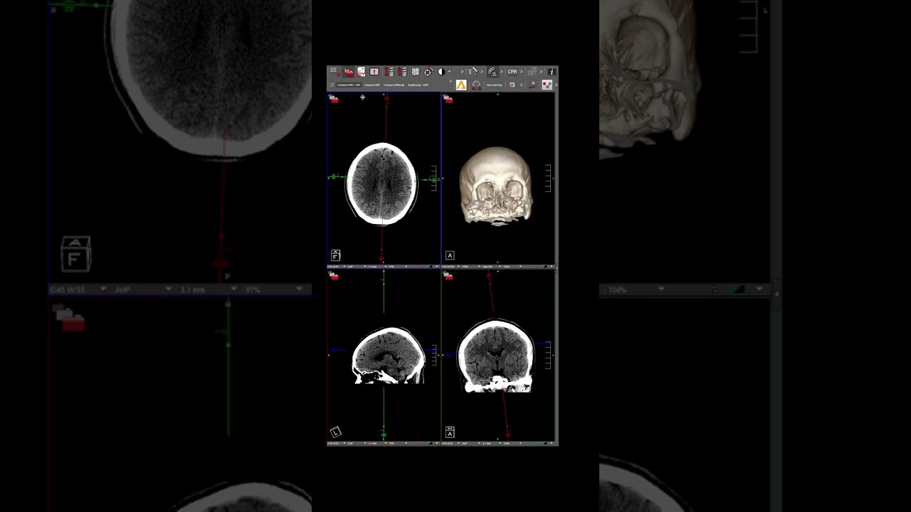How to Find, Arrange, and Set Default Hanging Protocols in Visage
