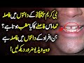 Meaning of gap between teeth urdu hindi  prophet saw k dantoun main fasla tha   urdu lab