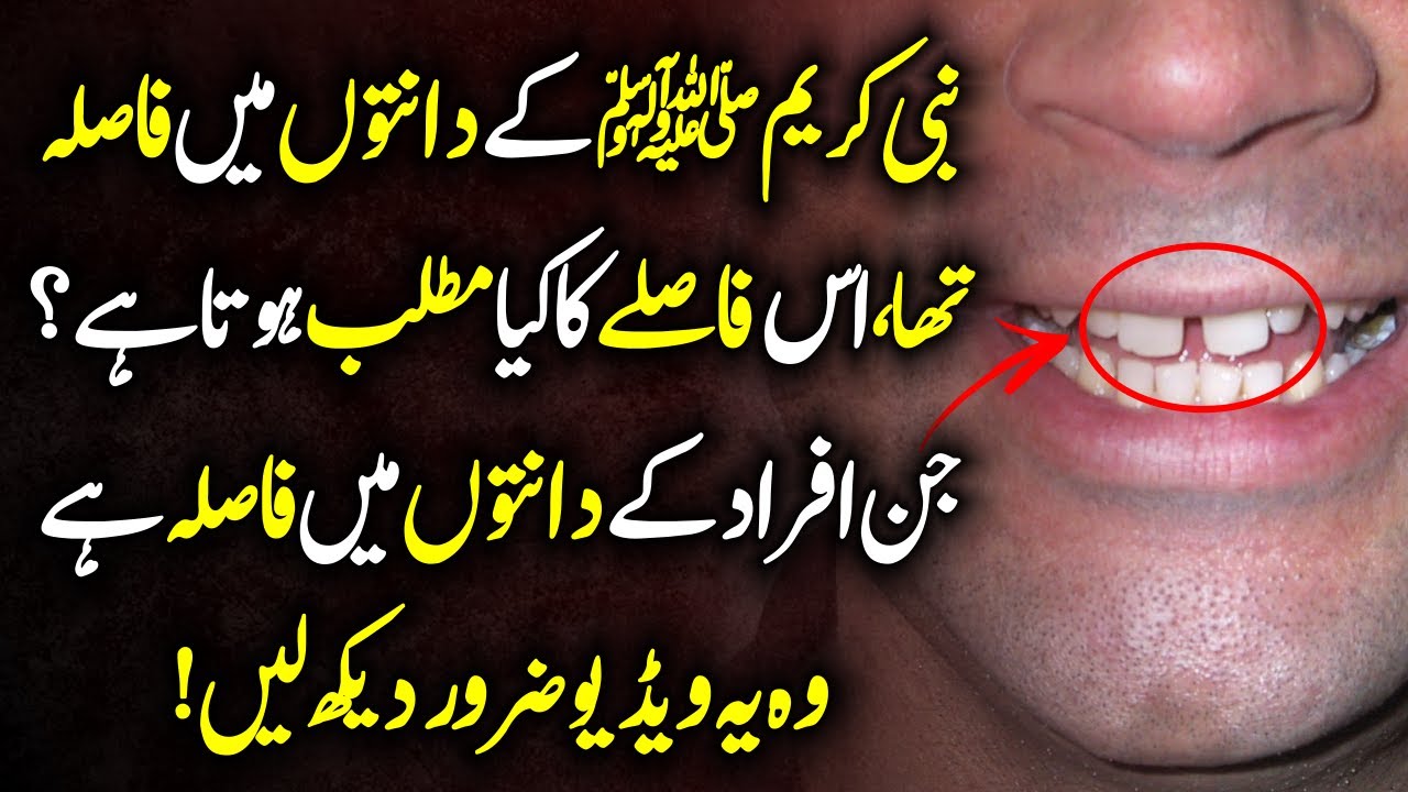 Meaning Of Gap Between Teeth Urdu Hindi Prophet SAW K Dantoun Main
