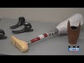 LOST LEGS IN FLIGHT: Luggage with prosthetic legs meant for African amputees still missing